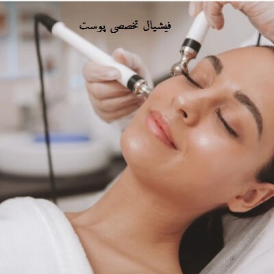 فشیال صورت