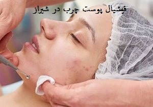 فیشیال مخصوص پوست‌های چرب در شیراز