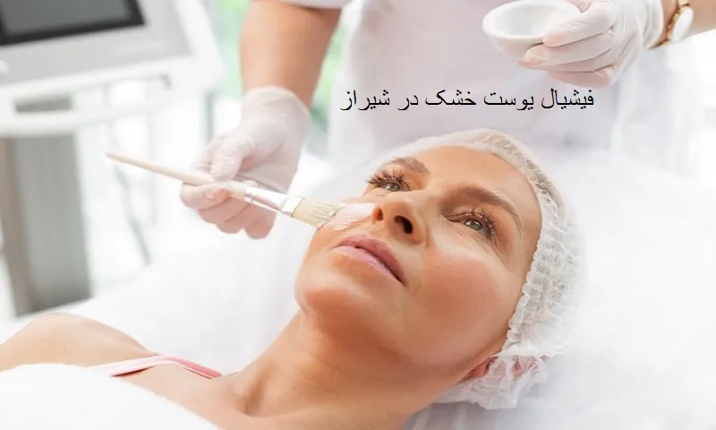 فیشیال پوست خشک در شیراز